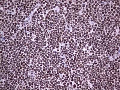 Immunohistochemistry: NIPP1 Antibody (OTI4E5) [NBP2-45386]