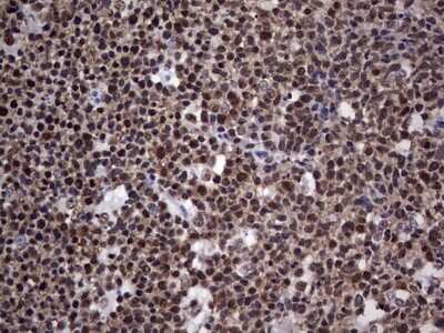 Immunohistochemistry: NIPP1 Antibody (OTI4E5) [NBP2-45386]