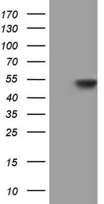 Western Blot: NIPP1 Antibody (OTI4E5) [NBP2-45386]