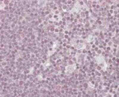 Immunohistochemistry-Paraffin: NIPP1 Antibody [NB100-1286]