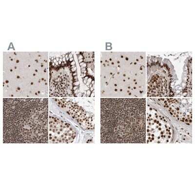 Immunohistochemistry-Paraffin: NIPP1 Antibody [NBP1-90112]