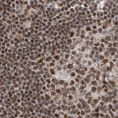 Immunohistochemistry-Paraffin: NIPP1 Antibody [NBP1-90112]