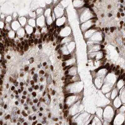Immunohistochemistry-Paraffin: NIPP1 Antibody [NBP1-90112]