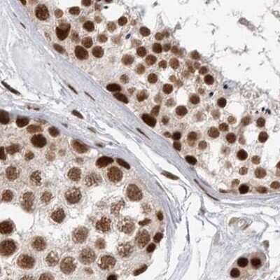Immunohistochemistry-Paraffin: NIPP1 Antibody [NBP1-90112]