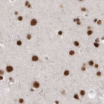 Immunohistochemistry-Paraffin: NIPP1 Antibody [NBP1-90112]