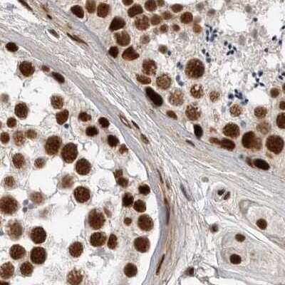 Immunohistochemistry-Paraffin: NIPP1 Antibody [NBP1-90113]