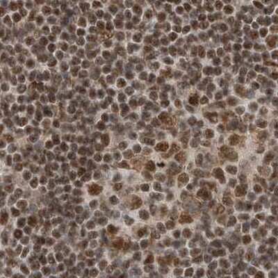 Immunohistochemistry-Paraffin: NIPP1 Antibody [NBP1-90113]