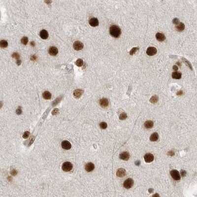 Immunohistochemistry-Paraffin: NIPP1 Antibody [NBP1-90113]