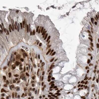Immunohistochemistry-Paraffin: NIPP1 Antibody [NBP1-90113]