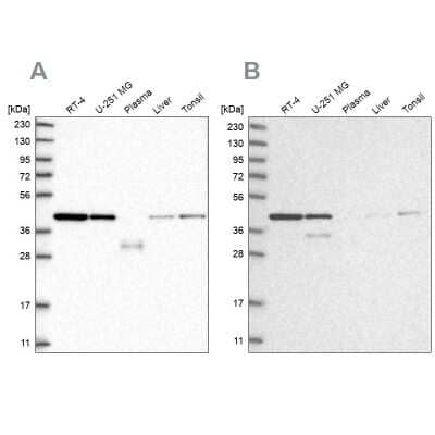 Western Blot: NIPP1 Antibody [NBP1-90112]