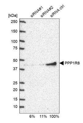 Western Blot: NIPP1 Antibody [NBP1-90113]