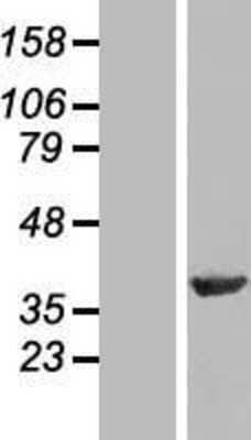 Western Blot: NIPP1 Overexpression Lysate [NBL1-14687]