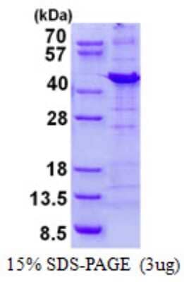 SDS-PAGE: Recombinant Human NIPP1 His Protein [NBP2-23382]