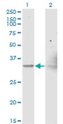 Western Blot: NIPSNAP1 Antibody (3B7) [H00008508-M15]