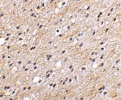 Immunohistochemistry: NIPSNAP1 Antibody - BSA Free [NBP1-76888]