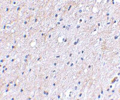 Immunohistochemistry-Paraffin: NIPSNAP1 Antibody - BSA Free [NBP1-76887]