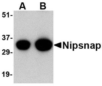 Western Blot: NIPSNAP1 AntibodyBSA Free [NBP1-76887]