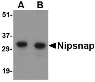 Western Blot: NIPSNAP1 AntibodyBSA Free [NBP1-76888]