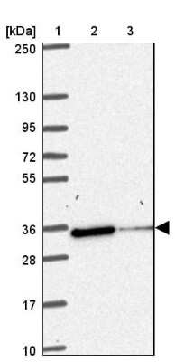 Western Blot: NIPSNAP1 Antibody [NBP2-31755]