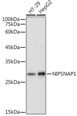 Western Blot: NIPSNAP1 AntibodyAzide and BSA Free [NBP3-05243]