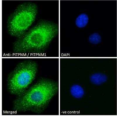 Immunocytochemistry/ Immunofluorescence: NIR2 Antibody [NB100-1417]