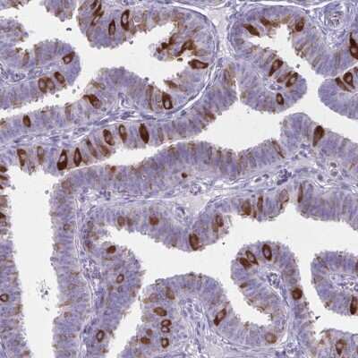 Immunohistochemistry-Paraffin: NIR2 Antibody [NBP2-34132]