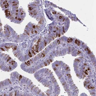 Immunohistochemistry-Paraffin: NIR2 Antibody [NBP2-34132]