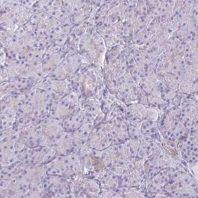 Immunohistochemistry-Paraffin: NIR2 Antibody [NBP2-34132]