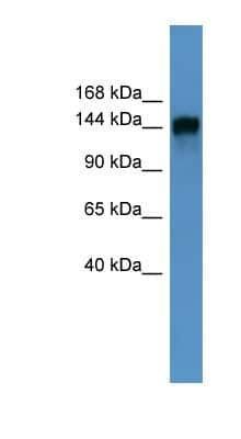 Western Blot: NIR2 Antibody [NBP1-69043]