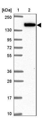 Western Blot: NIR2 Antibody [NBP2-34132]