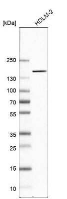 Western Blot: NIR2 Antibody [NBP2-34132]
