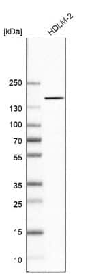 Western Blot: NIR2 Antibody [NBP2-34132]