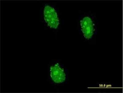 Immunocytochemistry/ Immunofluorescence: NIRF Antibody (3A11) [H00115426-M01]