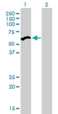 Western Blot: NIRF Antibody (3A11) [H00115426-M01]