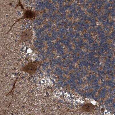 Immunohistochemistry-Paraffin: NISCH Antibody [NBP1-81630]