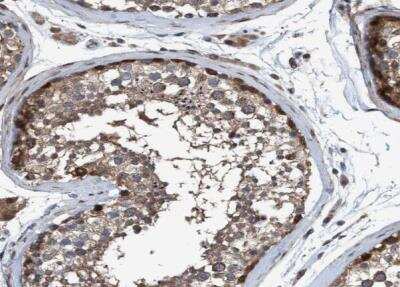 Immunohistochemistry-Paraffin: NISCH Antibody [NBP1-81630]
