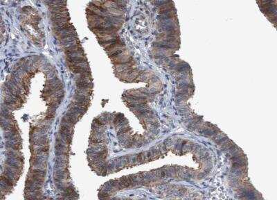 Immunohistochemistry-Paraffin: NISCH Antibody [NBP1-81630]