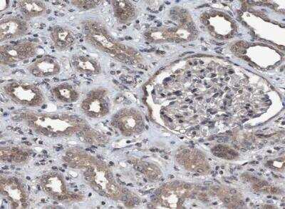 Immunohistochemistry-Paraffin: NISCH Antibody [NBP1-81630]