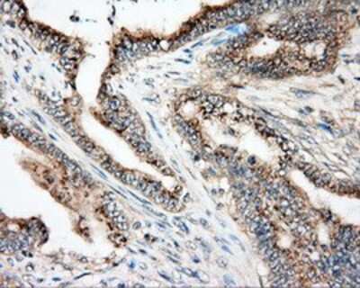 Immunohistochemistry-Paraffin: NIT2 Antibody (OTI2B9) [NBP2-02486]