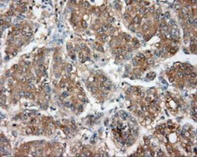 Immunohistochemistry-Paraffin: NIT2 Antibody (OTI2B9) [NBP2-02486]