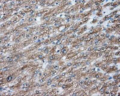 Immunohistochemistry-Paraffin: NIT2 Antibody (OTI2B9) [NBP2-02486]