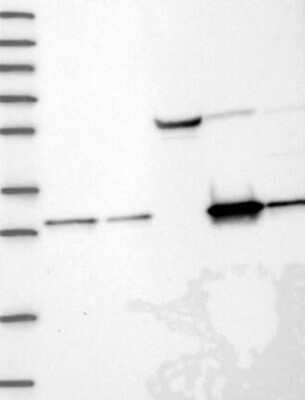 Western Blot: NIT2 Antibody [NBP3-17403]