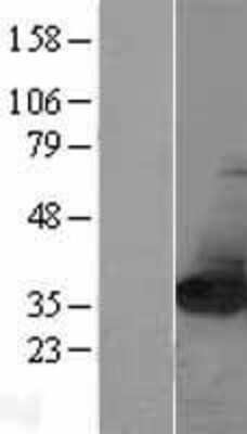 Western Blot: NIT2 Overexpression Lysate [NBL1-13649]