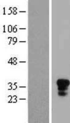 Western Blot: CD161 Overexpression Lysate [NBP2-10818]