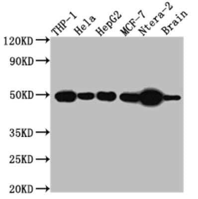 Western Blot: NK1R Antibody (1E5) [NBP3-15240]