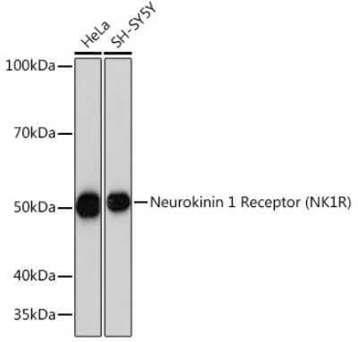 Western Blot: NK1R Antibody (9T1W2) [NBP3-16461]