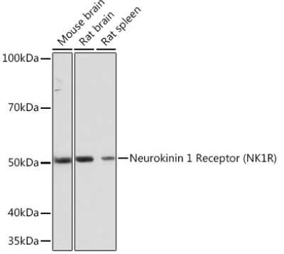 Western Blot: NK1R Antibody (9T1W2) [NBP3-16461]