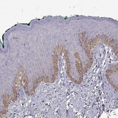 Immunohistochemistry-Paraffin: NK1R Antibody [NBP2-57675]