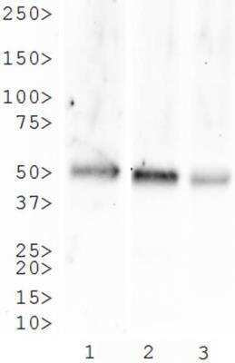 Western Blot: NK1R Antibody Pack [NB100-912]