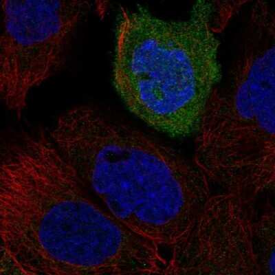 Immunocytochemistry/ Immunofluorescence: NK2R Antibody [NBP2-69018]